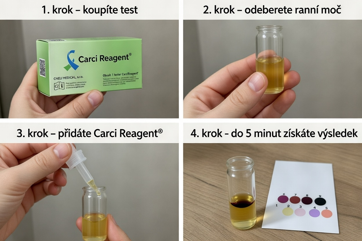 Čtyři kroky použití domácího testu Carci Reagent